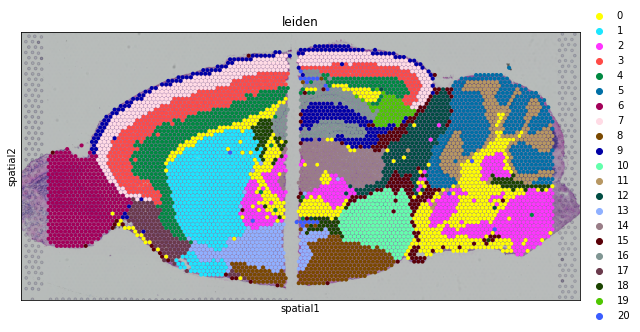 ../_images/tutorials_joint_mouse_brain_13_0.png