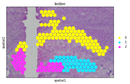 ../_images/tutorials_joint_mouse_brain_18_0.png