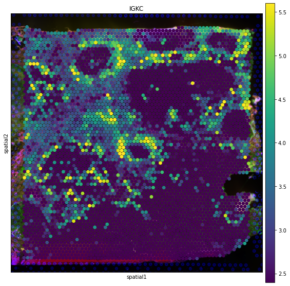 ../_images/tutorials_invasive_ductal_carcinoma_27_0.png